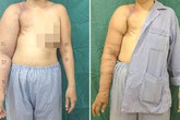Giải cứu người phụ nữ khỏi cánh tay voi Giải cứu người phụ nữ khỏi cánh tay voi